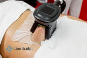 Are The Results From Aqualyx Permanent? 4 Compare Aqualyx Binley to other fat reduction treatments.