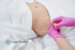 Are The Results From Aqualyx Permanent? 1 Do you want to know how long Aqualyx Binley results last?